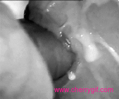 i luv to cumshot in her mouth..yesss baby swallow it Gif