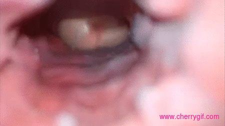 Inside injection Gif Gifs